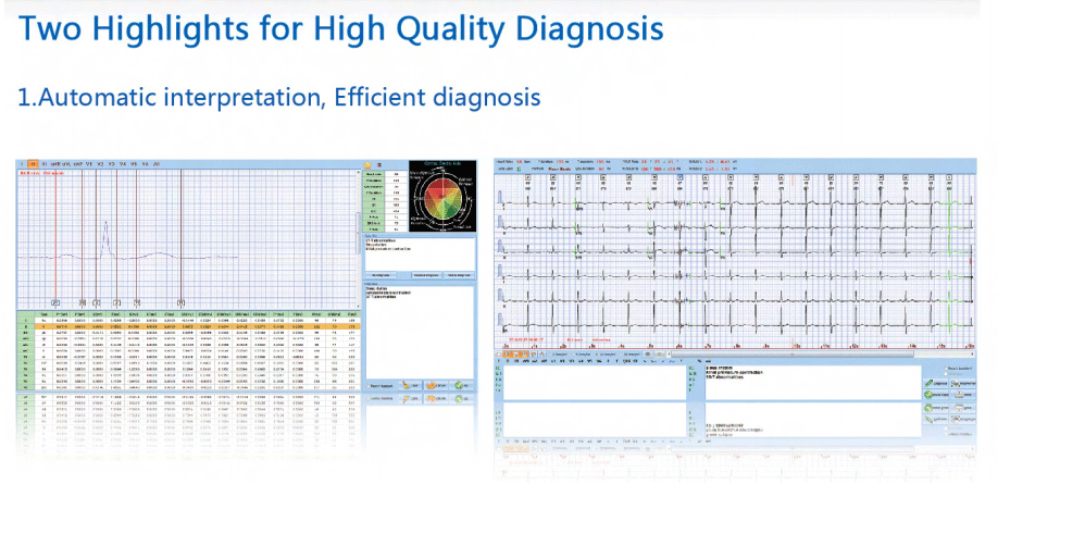 pc-ecg details